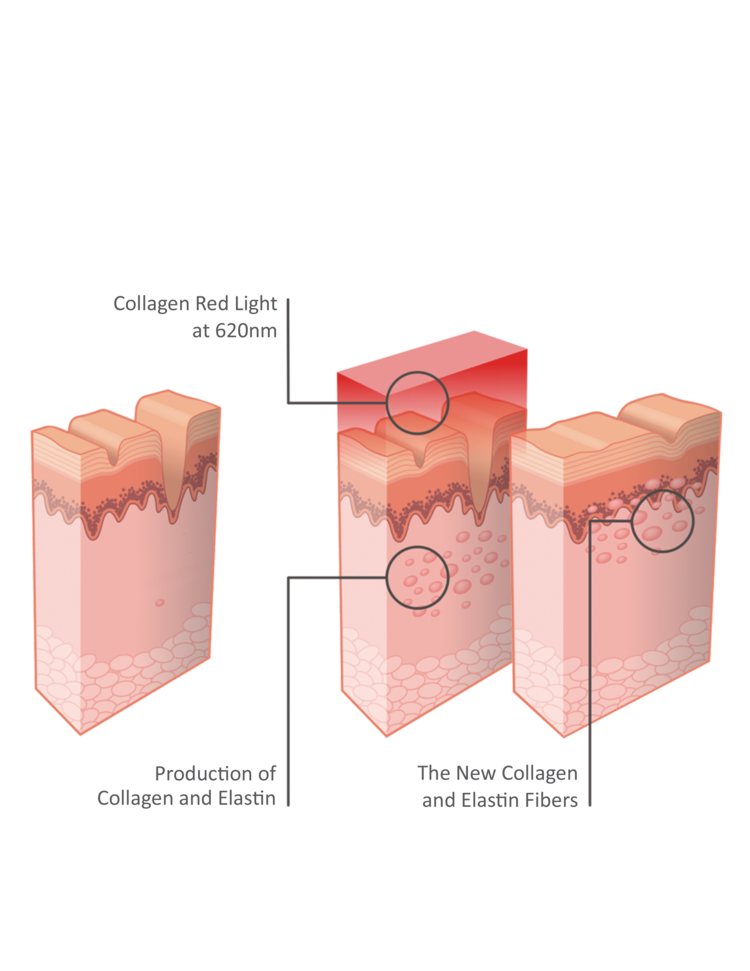 The RejuveMax the collagen bed that stimulates the fibers to rejuvenate the skin